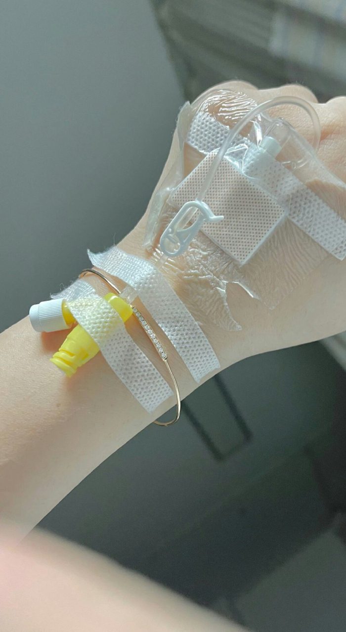 ảnh truyền nước ở tay nữ 11