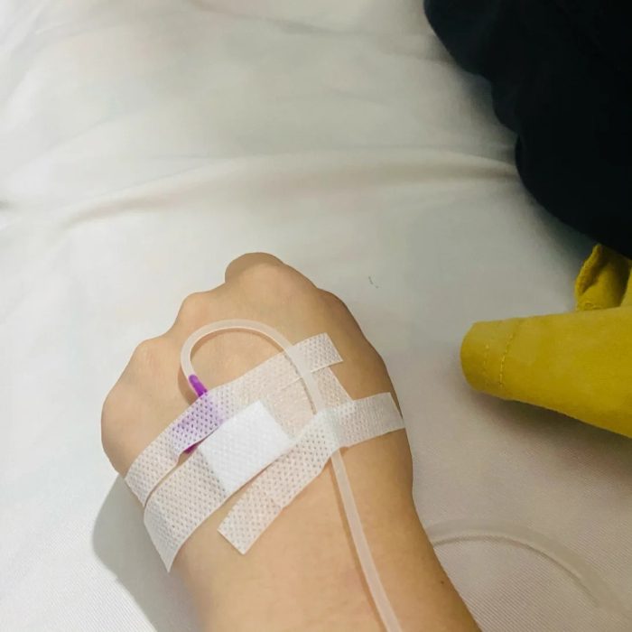 ảnh truyền nước ở tay nữ 21