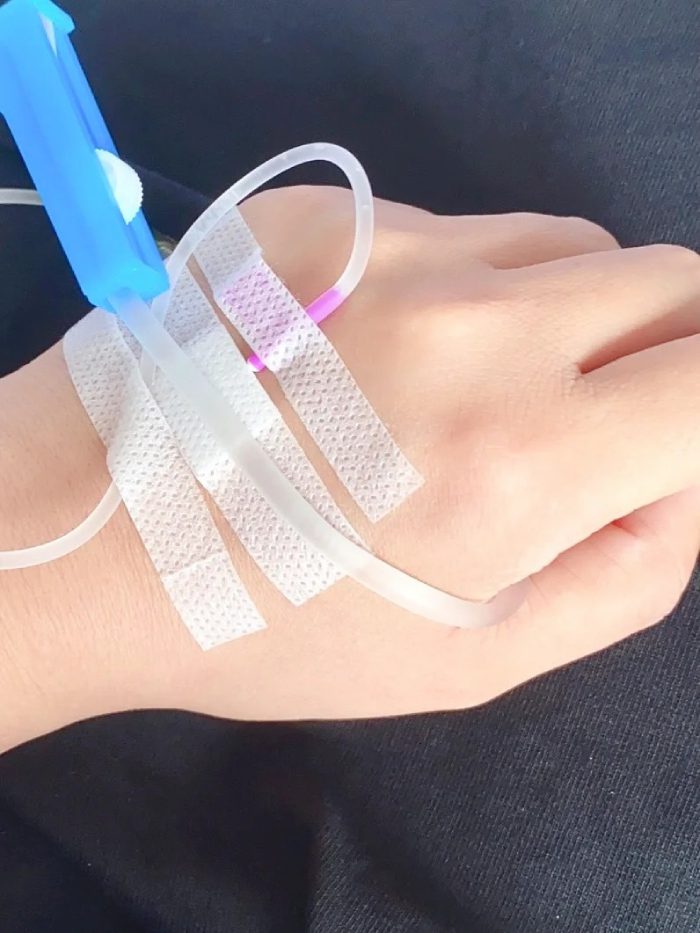 ảnh truyền nước ở tay nữ 23