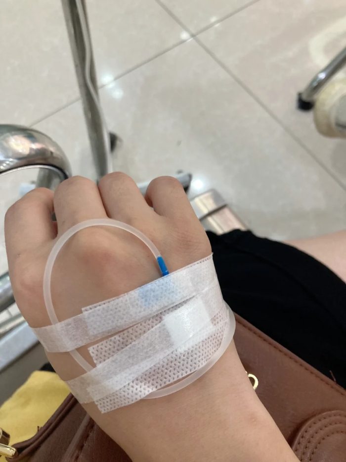 ảnh truyền nước ở tay nữ 26