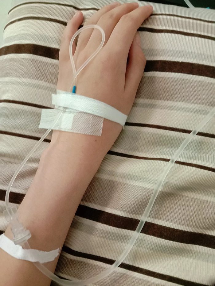 ảnh truyền nước ở tay nữ ở bệnh viện 