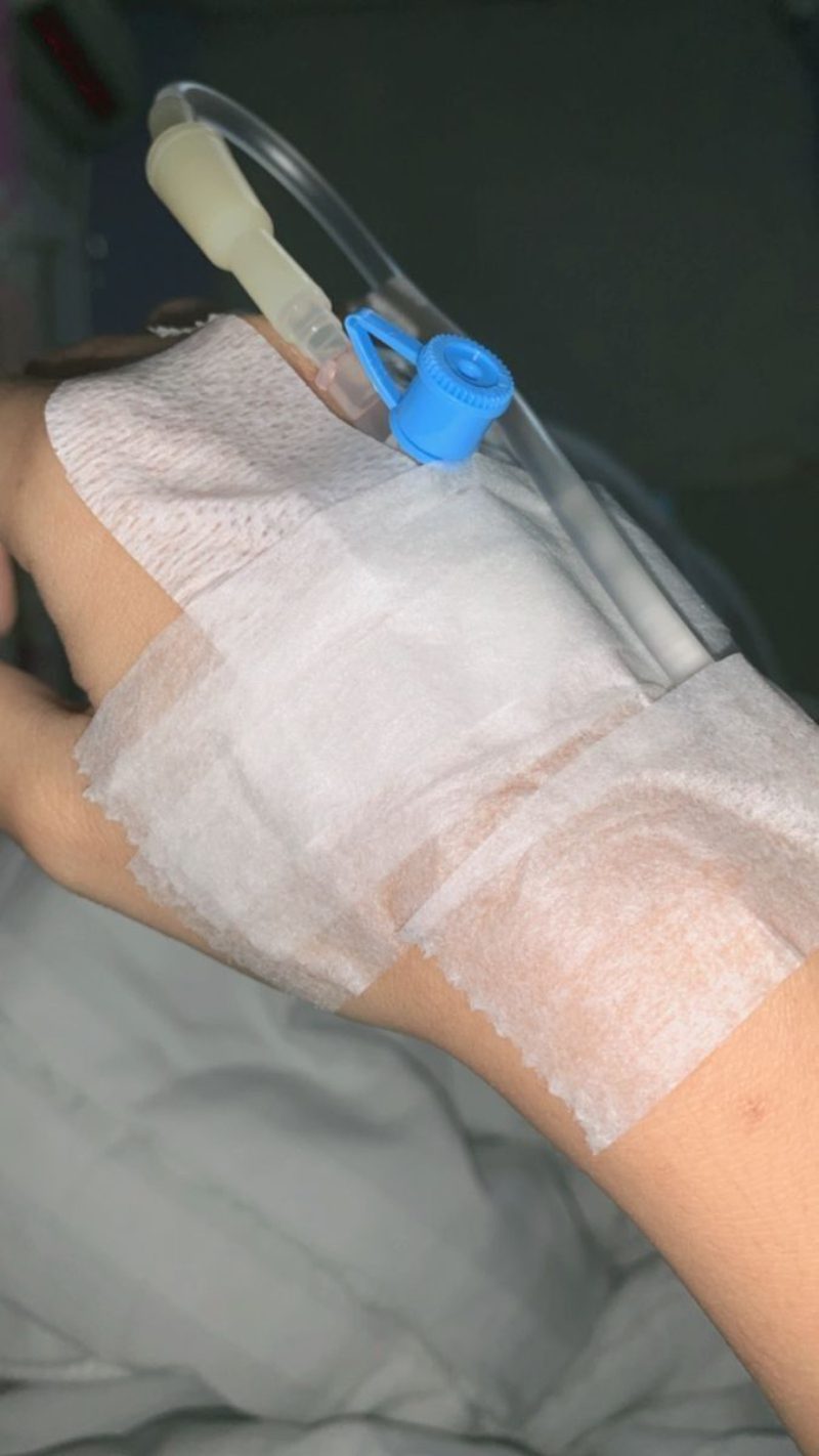 ảnh truyền nước ở tay nam 17