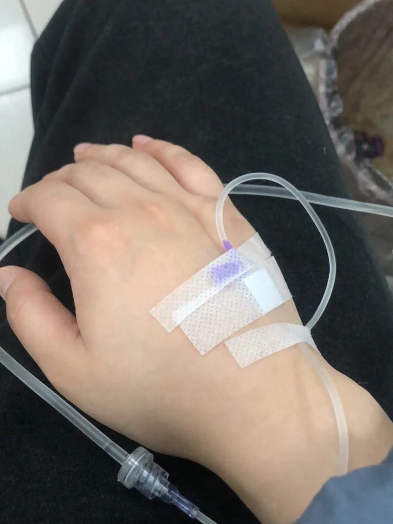 ảnh truyền nước ở tay nam 23