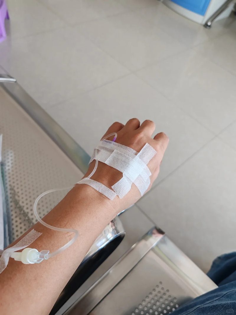 ảnh truyền nước ở tay nam 24