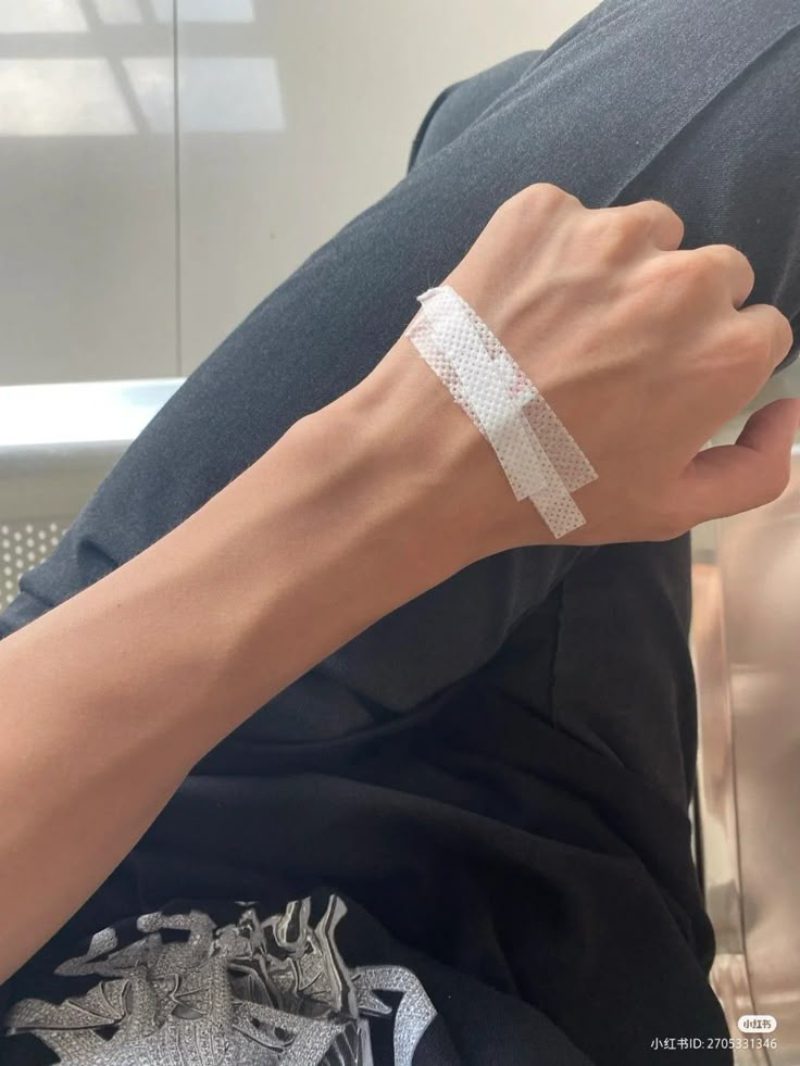 ảnh truyền nước ở tay nam 4